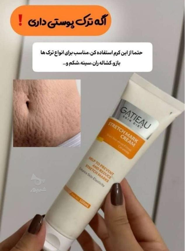کرم رفع ترک های پوستی بارداری  یا استرچ مارک برند گاتیو ایتالیا 100 میل